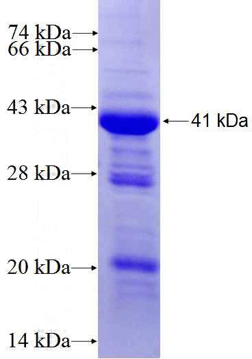Recombinant Human GPR116 SDS-PAGE