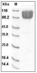 Human CD86 / B7-2 Protein (His & Fc Tag) SDS-PAGE