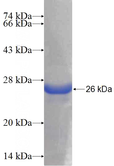 Recombinant Human LOH12CR1 SDS-PAGE