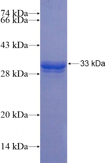 Recombinant Human TRIM4 SDS-PAGE