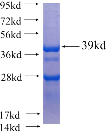 Recombinant Human CCND2 SDS-PAGE