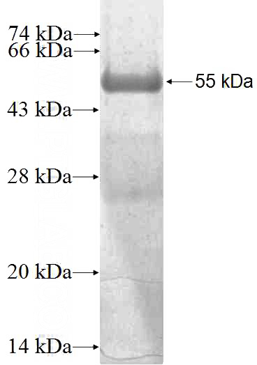 Recombinant Human ABI1 SDS-PAGE