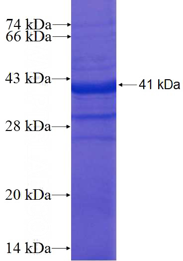 Recombinant Human UFD1L SDS-PAGE