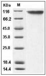 Human E-Selectin / CD62e / SELE Protein (His Tag) SDS-PAGE