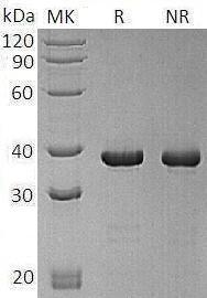 Human ATG3/APG3/APG3L recombinant protein