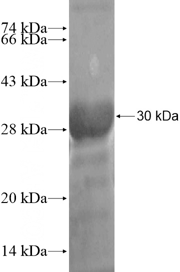 Recombinant Human ZNF483 SDS-PAGE