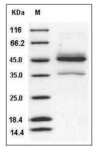 Human ALK4 / ACVR1B Protein (His & Fc Tag) SDS-PAGE