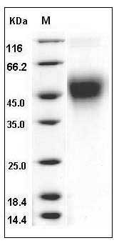 Mouse CD80 / B7-1 / CD28LG Protein (His Tag) SDS-PAGE