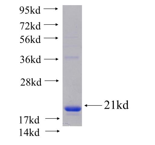 Recombinant human RPS12(Full length) SDS-PAGE