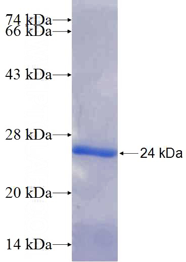 Recombinant Human CCNE2 SDS-PAGE