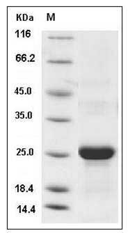 Mouse CLEC3B / Tetranectin Protein (His Tag) SDS-PAGE