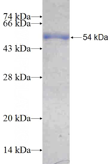Recombinant Human DTX2 SDS-PAGE