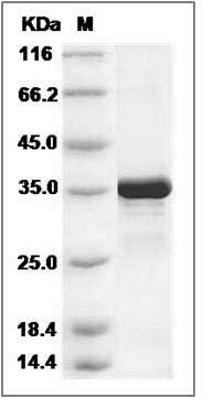 Human GALE / UDP galactose-4-epimerase Protein (His Tag) SDS-PAGE
