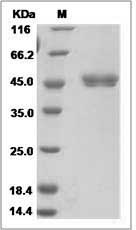 Rat Cathepsin E / CTSE Protein (His Tag)