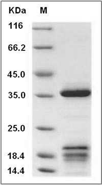 Cynomolgus IGFBP2 Protein (His Tag) SDS-PAGE