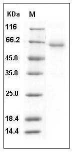Human CXADR / CAR Protein (His & Fc Tag) SDS-PAGE