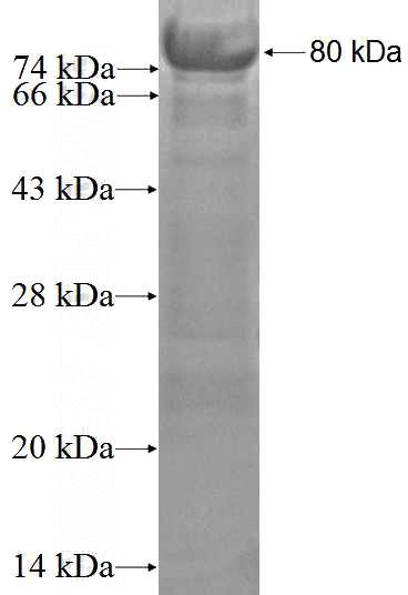 Recombinant Human RAD23B SDS-PAGE