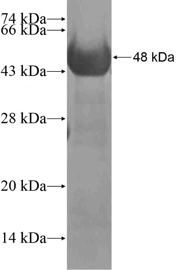 Recombinant Human TRPM4 SDS-PAGE