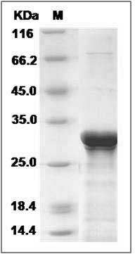 Human SMNDC1 / SPF30 Protein (His Tag) SDS-PAGE