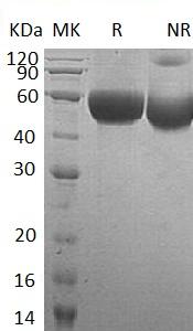 Human NTM/IGLON2/NT/UNQ297/PRO337 (His tag) recombinant protein