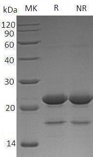 Human ZBTB17/MIZ1/ZNF151/ZNF60 (His tag) recombinant protein