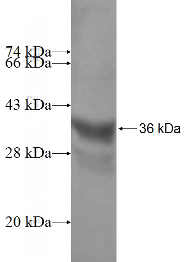 Recombinant Human SLC30A2 SDS-PAGE