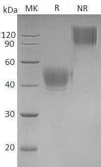 Human CD24/CD24A (Fc tag) recombinant protein