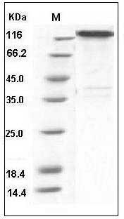 Human CD30 / TNFRSF8 Protein (His & Fc Tag) SDS-PAGE