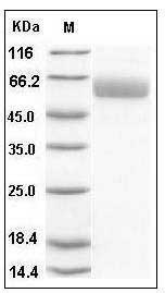 Mouse SerpinA7 / TBG Protein (His Tag) SDS-PAGE