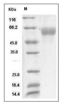 Influenza A H12N1 (A/mallard duck/Alberta/342/1983) Hemagglutinin Protein (HA1 Subunit) (His Tag) SDS-PAGE