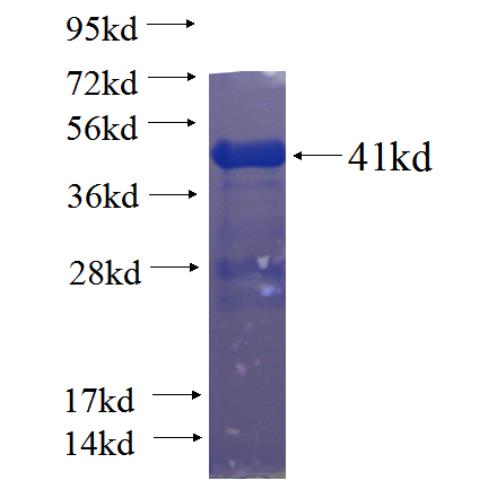Recombinant human C2orf3 SDS-PAGE