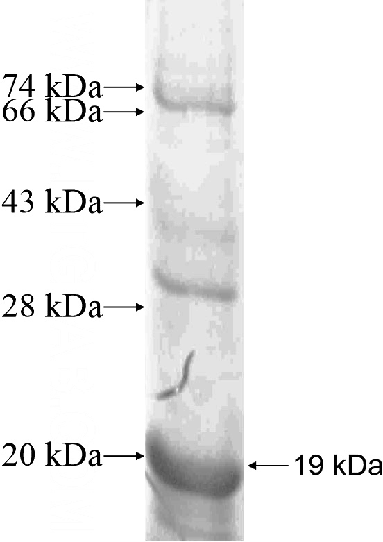 Recombinant Human SAG SDS-PAGE