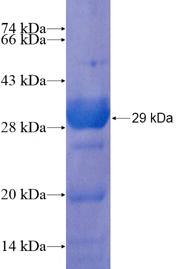 Recombinant Human NBEAL1 SDS-PAGE