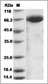 Canine NRG1-alpha Protein (Fc Tag) SDS-PAGE