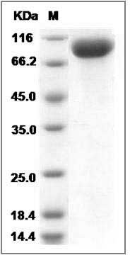 Influenza A H1N1 (A/California/07/2009) Hemagglutinin / HA Protein (His Tag) SDS-PAGE
