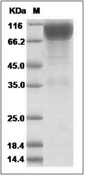 Cynomolgus IL17RA / IL17R Protein (Fc Tag) SDS-PAGE