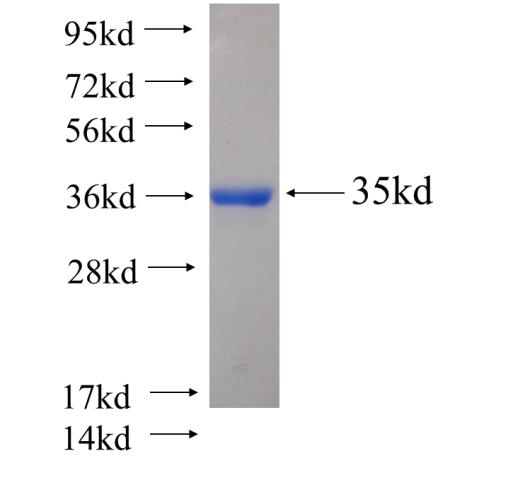 Recombinant human SMARCD3 SDS-PAGE