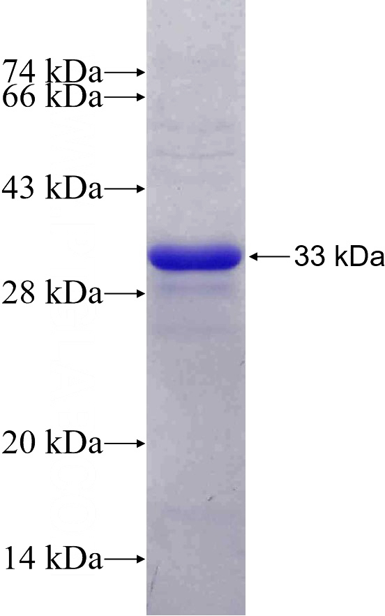 Recombinant Human NR4A1 SDS-PAGE