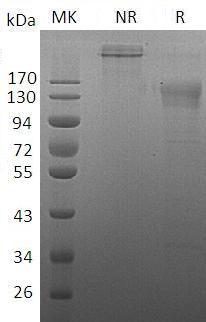 Human CD96 (Fc tag) recombinant protein