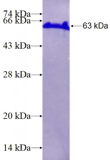 Recombinant Human PTEN SDS-PAGE