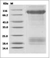 Ebola virus EBOV (subtype Zaire, strain Mayinga 1976) Glycoprotein / GP Protein (His Tag)