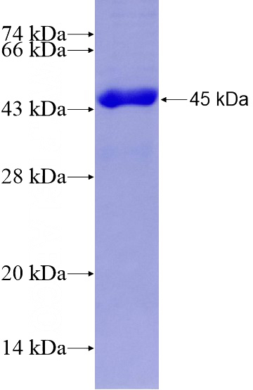 Mouse Cdkn2a Recombinant protein (GST tag)