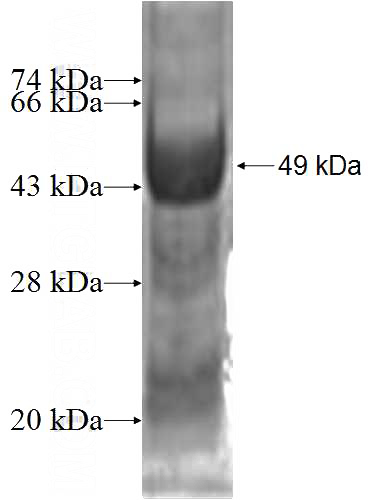 Recombinant Human RHOD SDS-PAGE