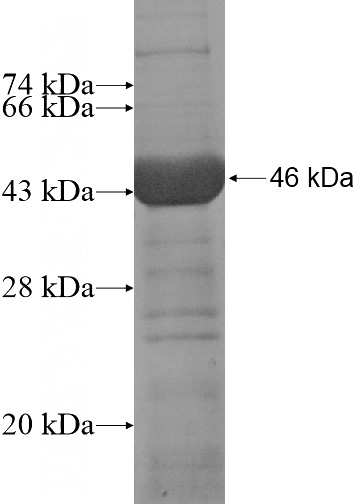 Recombinant Human ADH1A SDS-PAGE
