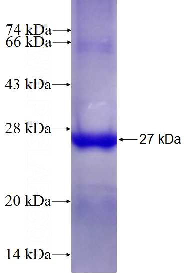 Recombinant Human ICA1L SDS-PAGE