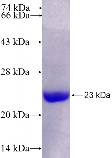 Recombinant Human TM9SF3 SDS-PAGE