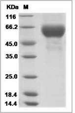 Influenza A H3N2 (A/Hanoi/EL201/2009) Hemagglutinin / HA1 Protein (His Tag)