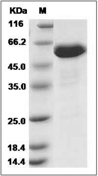 Canine Ephrin-A5 / EFNA5 Protein (Fc Tag) SDS-PAGE