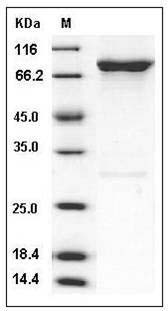 Human GRK6 / GPRK6 Protein (His & GST Tag) SDS-PAGE