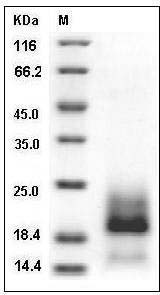 Human BAMBI / NMA Protein (His Tag) SDS-PAGE